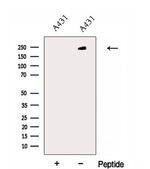 EXPH5 Antibody in Western Blot (WB)