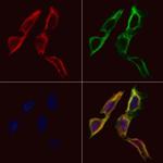 FAM134B Antibody in Immunocytochemistry (ICC/IF)