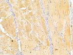 FKTN Antibody in Immunohistochemistry (Paraffin) (IHC (P))