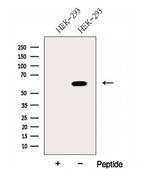 FUT8 Antibody in Western Blot (WB)