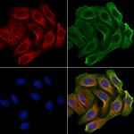 GALNT14 Antibody in Immunocytochemistry (ICC/IF)