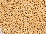 GINS3 Antibody in Immunohistochemistry (Paraffin) (IHC (P))