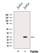 GINS3 Antibody in Western Blot (WB)