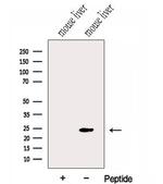 GNPNAT1 Antibody in Western Blot (WB)