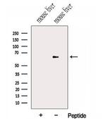 HAS3 Antibody in Western Blot (WB)