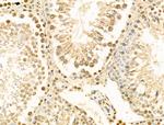 HERC5 Antibody in Immunohistochemistry (Paraffin) (IHC (P))