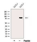 hnRNP R Antibody in Western Blot (WB)