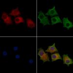 STCH Antibody in Immunocytochemistry (ICC/IF)