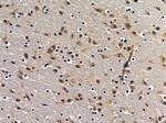 STCH Antibody in Immunohistochemistry (Paraffin) (IHC (P))