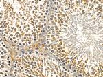 INPP5B Antibody in Immunohistochemistry (Paraffin) (IHC (P))