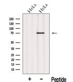 INPP5B Antibody in Western Blot (WB)