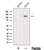 INTS8 Antibody in Western Blot (WB)