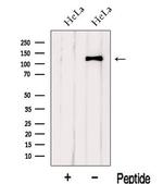 IWS1 Antibody in Western Blot (WB)