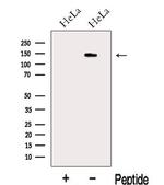 KIAA1033 Antibody in Western Blot (WB)