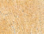 KIF19 Antibody in Immunohistochemistry (Paraffin) (IHC (P))