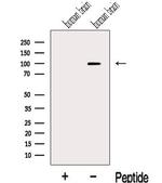 KIF19 Antibody in Western Blot (WB)