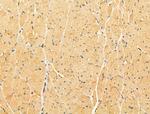 LACTB2 Antibody in Immunohistochemistry (Paraffin) (IHC (P))