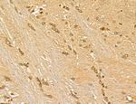 LAS1L Antibody in Immunohistochemistry (Paraffin) (IHC (P))