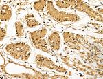 LAS1L Antibody in Immunohistochemistry (Paraffin) (IHC (P))