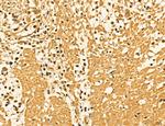 LAS1L Antibody in Immunohistochemistry (Paraffin) (IHC (P))