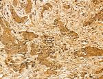 LAS1L Antibody in Immunohistochemistry (Paraffin) (IHC (P))