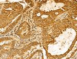 LAS1L Antibody in Immunohistochemistry (Paraffin) (IHC (P))