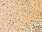 LAS1L Antibody in Immunohistochemistry (Paraffin) (IHC (P))