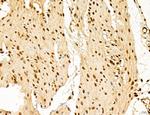 LAS1L Antibody in Immunohistochemistry (Paraffin) (IHC (P))