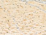 LAS1L Antibody in Immunohistochemistry (Paraffin) (IHC (P))