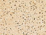 LAS1L Antibody in Immunohistochemistry (Paraffin) (IHC (P))