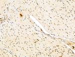 LAS1L Antibody in Immunohistochemistry (Paraffin) (IHC (P))