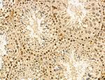 LAS1L Antibody in Immunohistochemistry (Paraffin) (IHC (P))