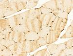 LAS1L Antibody in Immunohistochemistry (Paraffin) (IHC (P))