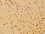 LAS1L Antibody in Immunohistochemistry (Paraffin) (IHC (P))