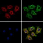 MAP1LC3C Antibody in Immunocytochemistry (ICC/IF)