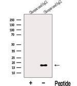 MAP1LC3C Antibody in Western Blot (WB)