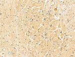 LOH12CR1 Antibody in Immunohistochemistry (Paraffin) (IHC (P))