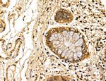 LOH12CR1 Antibody in Immunohistochemistry (Paraffin) (IHC (P))