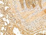 LOH12CR1 Antibody in Immunohistochemistry (Paraffin) (IHC (P))