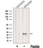 LOH12CR1 Antibody in Western Blot (WB)