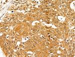 MAN1A2 Antibody in Immunohistochemistry (Paraffin) (IHC (P))