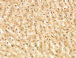 MAP1S Antibody in Immunohistochemistry (Paraffin) (IHC (P))