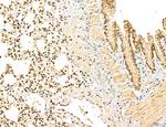 MAP1S Antibody in Immunohistochemistry (Paraffin) (IHC (P))