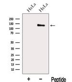 MAP1S Antibody in Western Blot (WB)