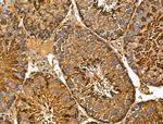 MIPEP Antibody in Immunohistochemistry (Paraffin) (IHC (P))