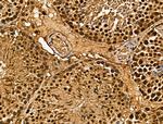 MSRA Antibody in Immunohistochemistry (Paraffin) (IHC (P))