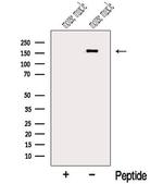 MYOM3 Antibody in Western Blot (WB)