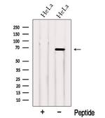 NCOA5 Antibody in Western Blot (WB)