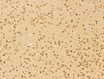 NCOA6 Antibody in Immunohistochemistry (Paraffin) (IHC (P))