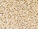 NCOA6 Antibody in Immunohistochemistry (Paraffin) (IHC (P))